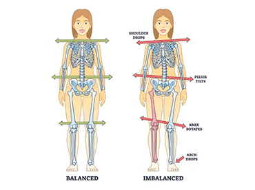 Diferença de comprimento das pernas